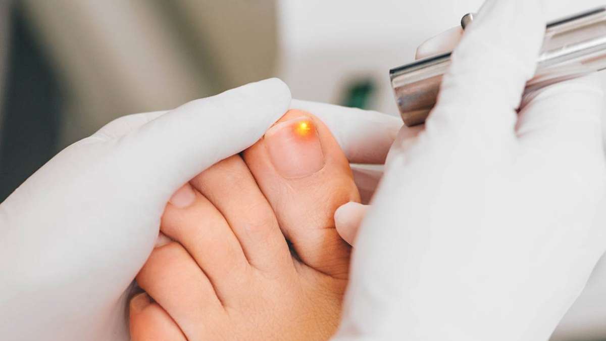 This Is Why Your Toenails Smell So Bad | livestrong